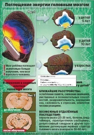 Мобильный телефон и рак мозга Мобильный телефон и рак мозга