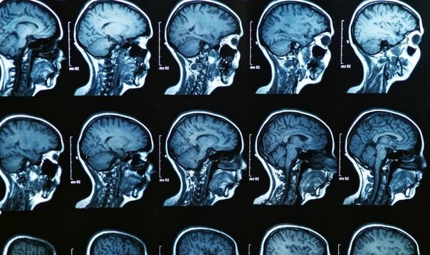 Пять мифов о мозге