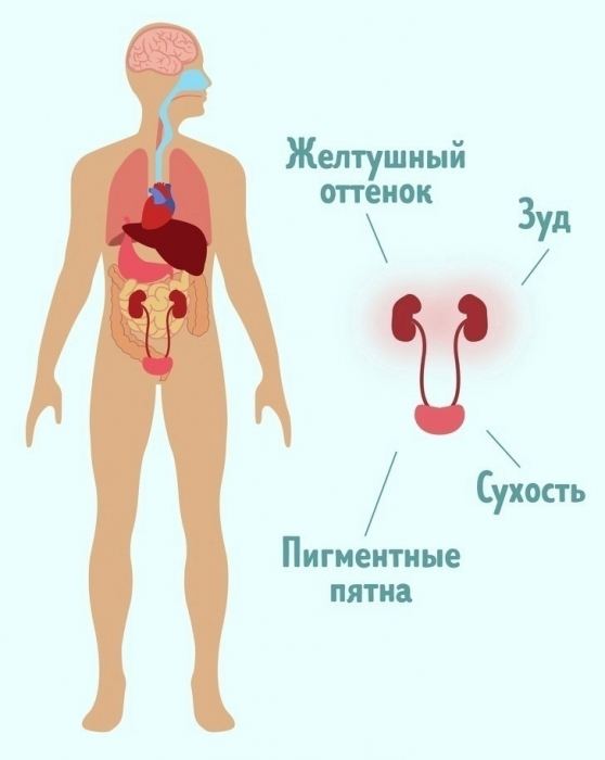 7 СКРЫТЫХ СИМПТОМОВ, КОТОРЫЕ ГОВОРЯТ О ТОМ, ЧТО С ПОЧКАМИ БЕДА 7 СКРЫТЫХ СИМПТОМОВ, КОТОРЫЕ ГОВОРЯТ О ТОМ, ЧТО С ПОЧКАМИ БЕДА