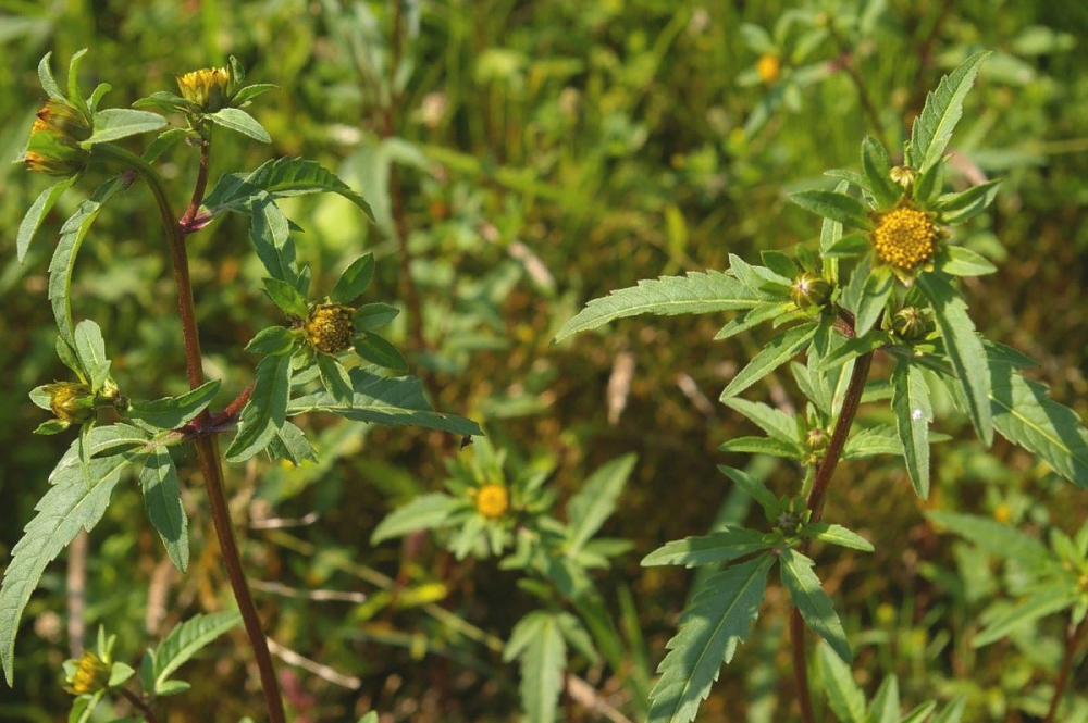 Детская болезнь рахит.