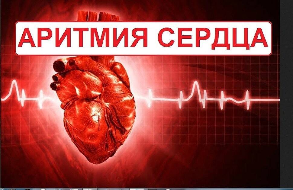 АРИТМИЯ: НАРОДНЫЕ СРЕДСТВА, ЛЕЧЕНИЕ АРИТМИИ