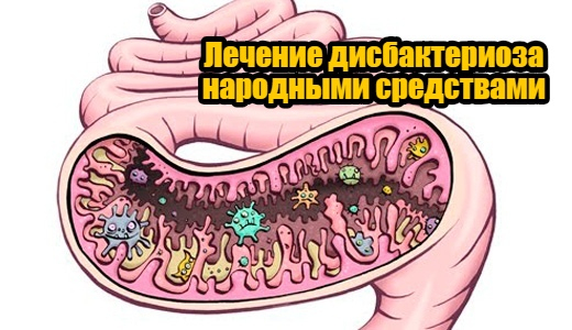 Лечение дисбактериоза народными средствами